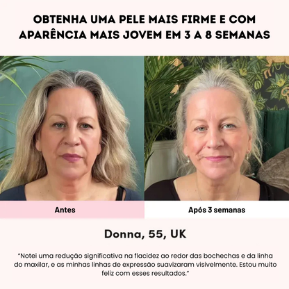 LUNA&SKIN RegenMask™